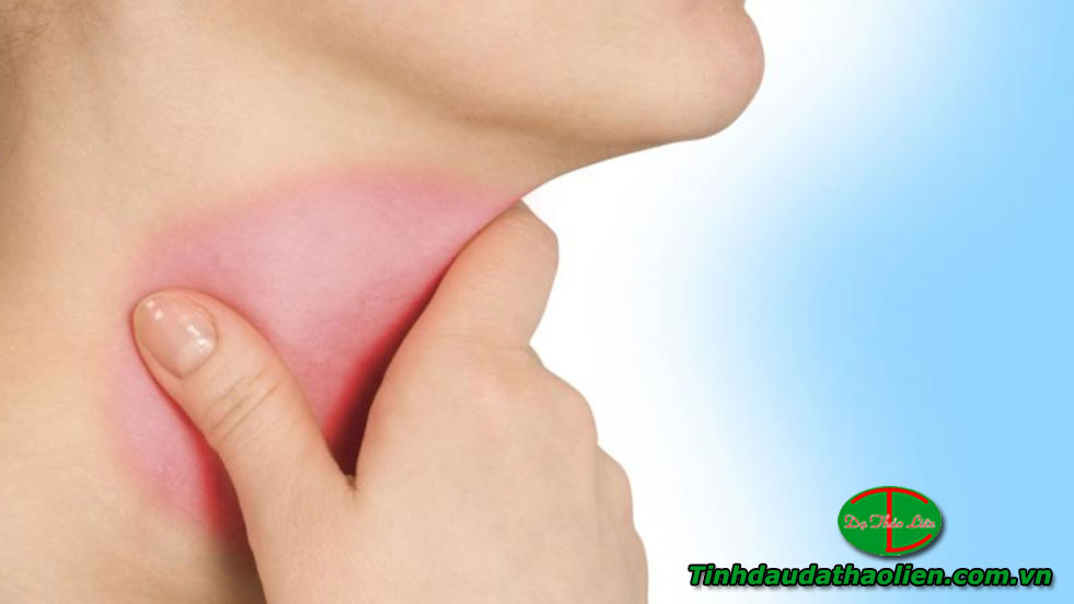 Dấu hiệu viêm họng hạt