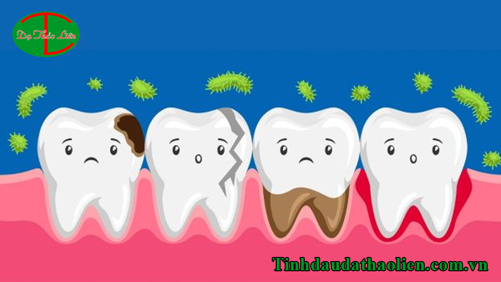 Trị dứt điểm sâu răng