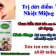 trị nhiệt miệng bằng tinh dầu răng miệng Dạ Thảo Liên