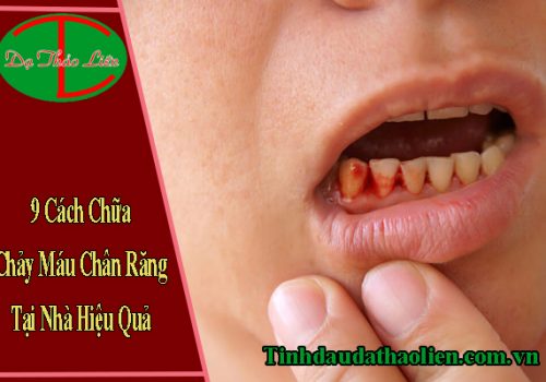 Chảy máu chân răng