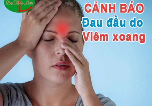 đau đầu do viêm xoang