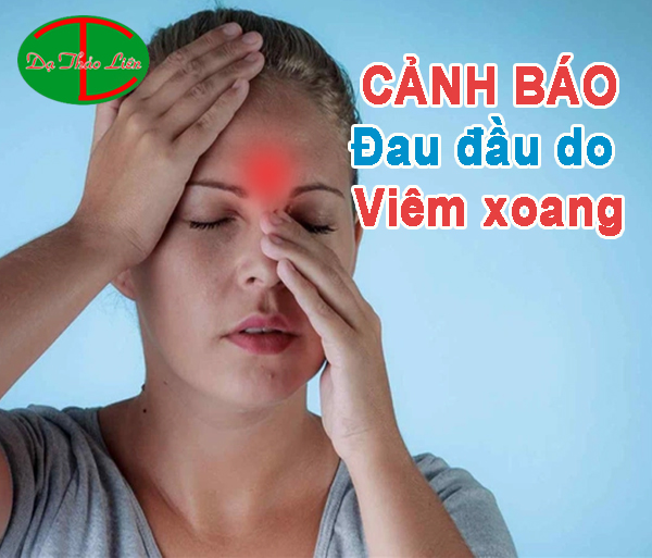 đau đầu do viêm xoang
