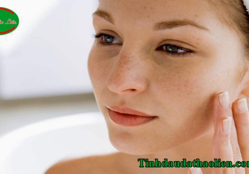 Cách trị nám tàn nhang lâu năm