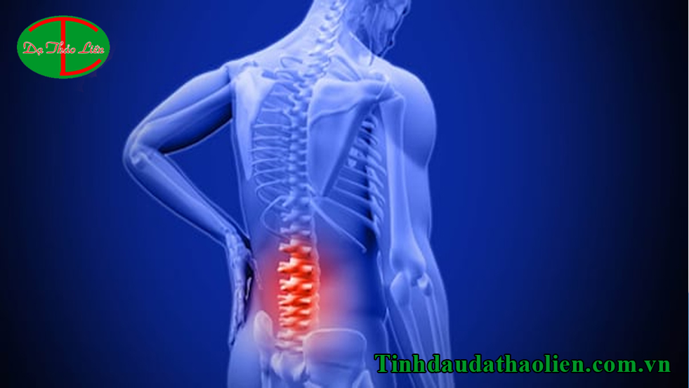 Cách trị đau lưng