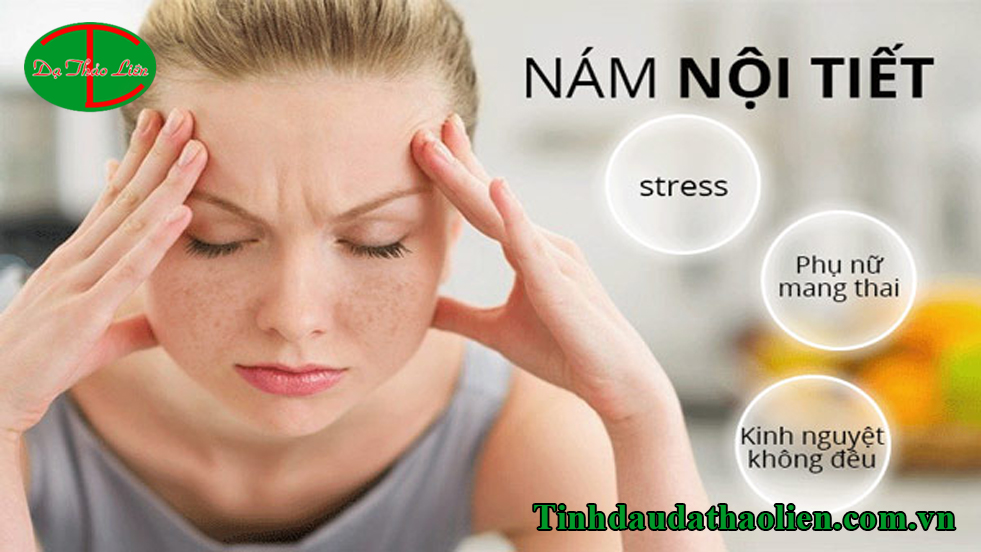 nám da sau sinh có tự hết không