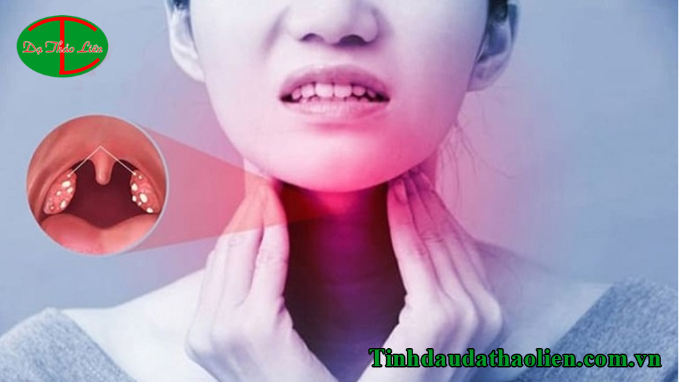 Cách điều trị viêm amidan hốc mủ tại nhà