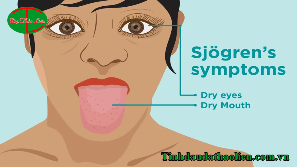 Đánh răng xong vẫn bị hôi miệng