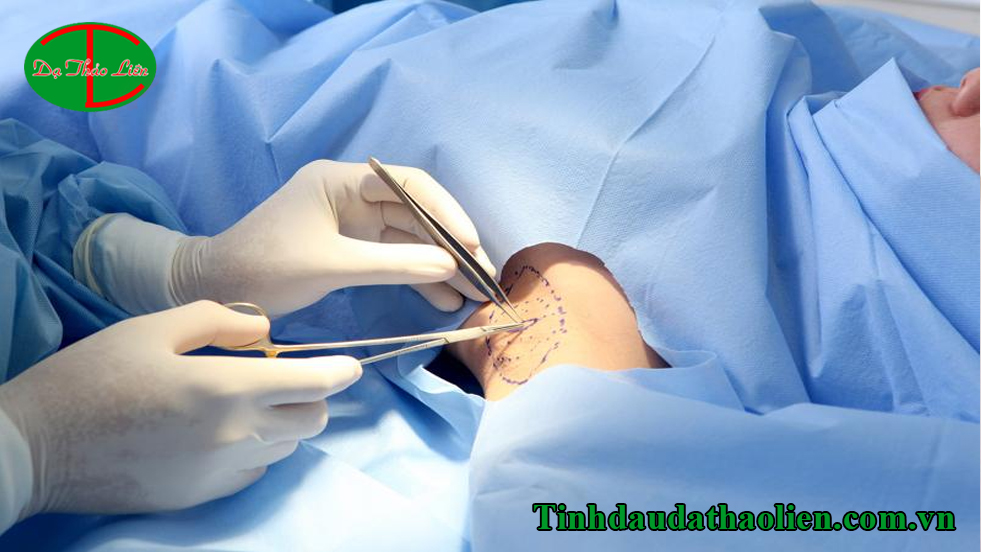 Hôi nách có lây không