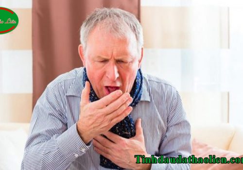 Viêm họng cấp tính