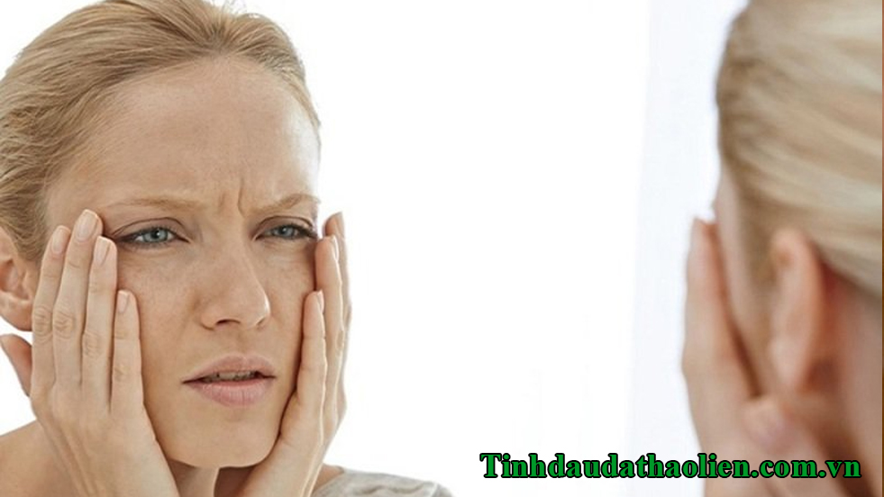 Da bị cháy nắng phải làm sao